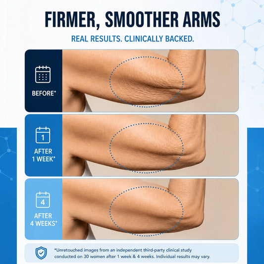 Firmer, smoother arms — before and after results
