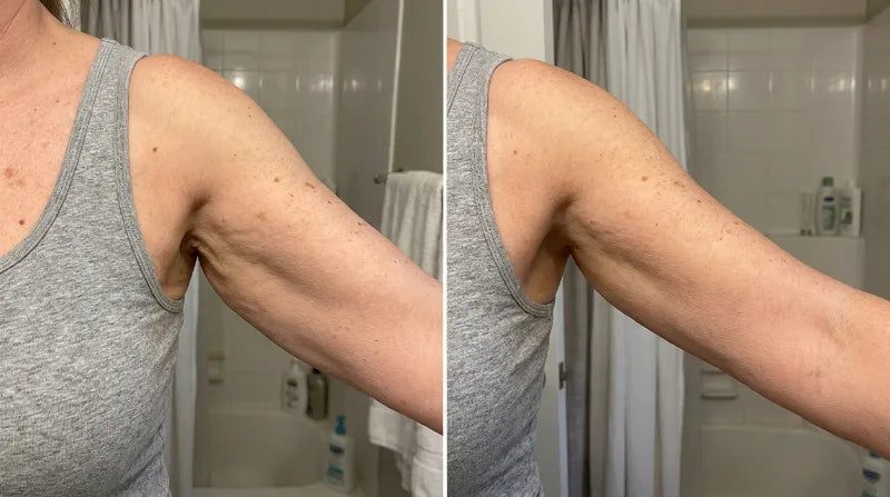 Before and after
