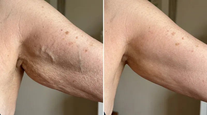 Before and after