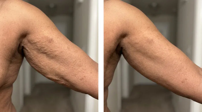 Before and after arm results