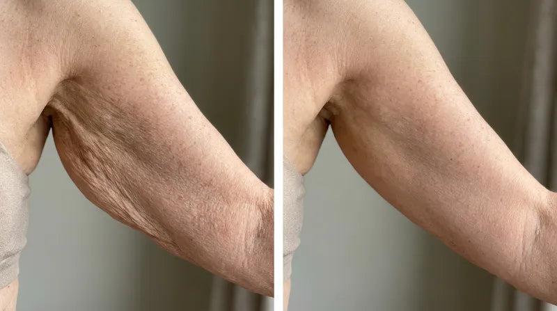 Before and after