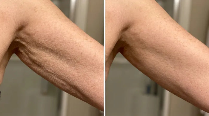 Before and after arm results