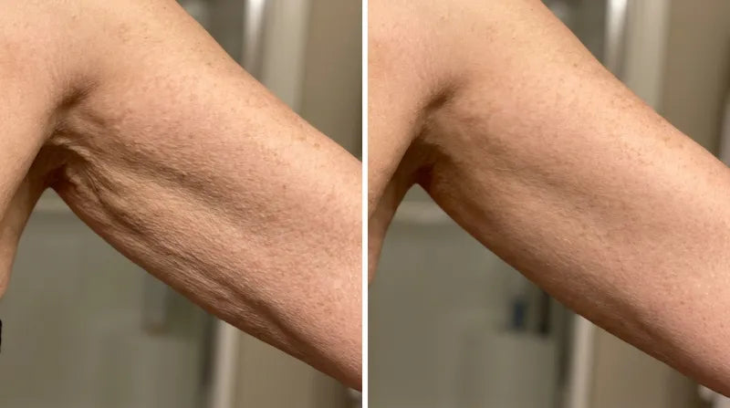 Before and after